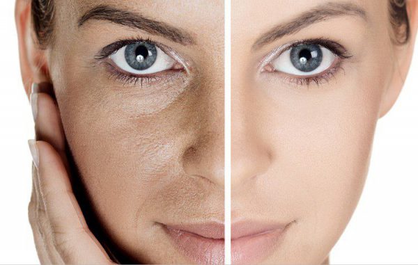 ماسک صورت برای درمان منافذ باز پوست