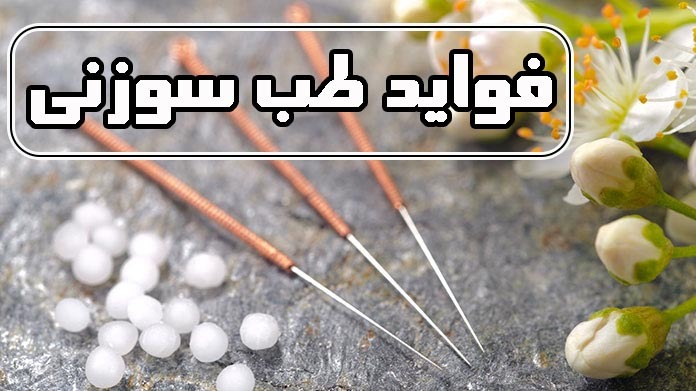 فواید طب سوزنی